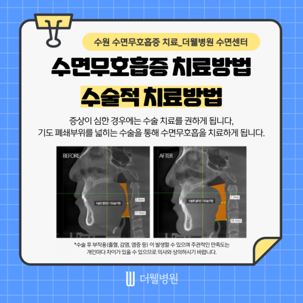 81c459518a8f42191a914d71587de7d0_1787643579_9092.png